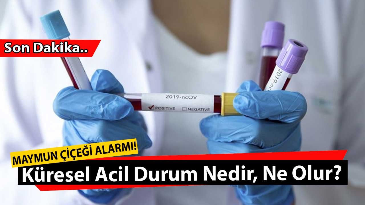 Dünya Sağlık Örgütünden Maymun Çiçeği hakkında flaş karar! Küresel acil durum nedir, ne demek?